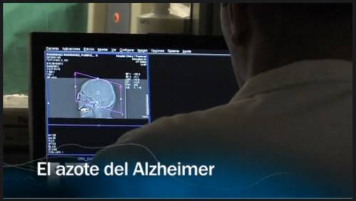 El azote del Alzheimer