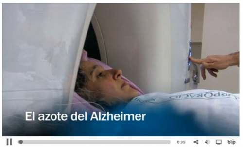 Los estragos del Alzheimer
